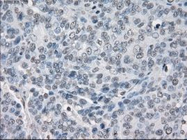 PP5 Antibody in Immunohistochemistry (Paraffin) (IHC (P))