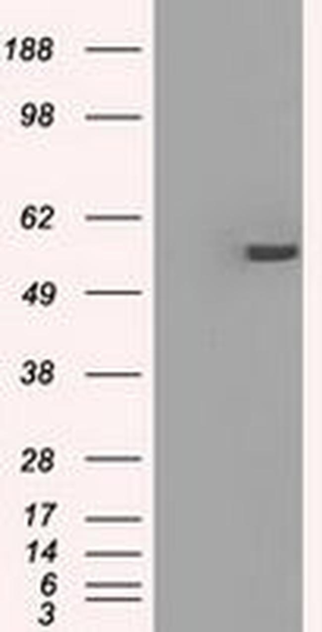 PP5 Antibody in Western Blot (WB)