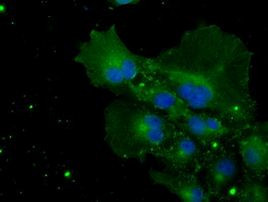 Cytochrome P450 Reductase Antibody in Immunocytochemistry (ICC/IF)