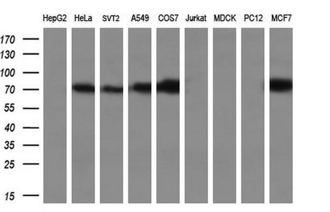 Cytochrome P450 Reductase Antibody in Western Blot (WB)