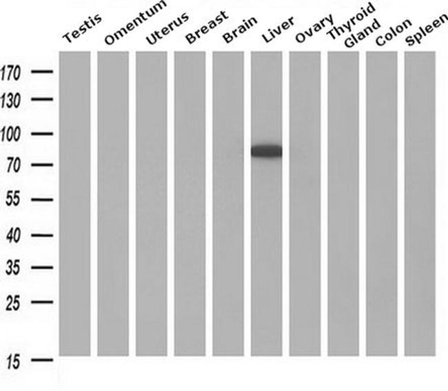 Cytochrome P450 Reductase Antibody in Western Blot (WB)