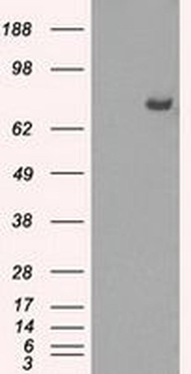 Cytochrome P450 Reductase Antibody in Western Blot (WB)