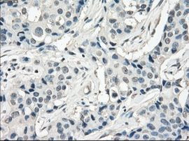 Fra1 Antibody in Immunohistochemistry (Paraffin) (IHC (P))