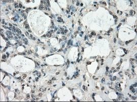 Fra1 Antibody in Immunohistochemistry (Paraffin) (IHC (P))