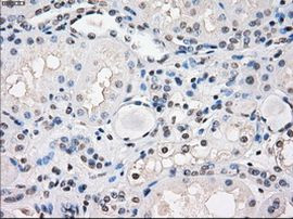 Fra1 Antibody in Immunohistochemistry (Paraffin) (IHC (P))