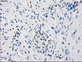 Fra1 Antibody in Immunohistochemistry (Paraffin) (IHC (P))