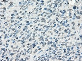 Fra1 Antibody in Immunohistochemistry (Paraffin) (IHC (P))