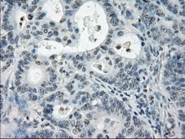 PDE10A Antibody in Immunohistochemistry (Paraffin) (IHC (P))