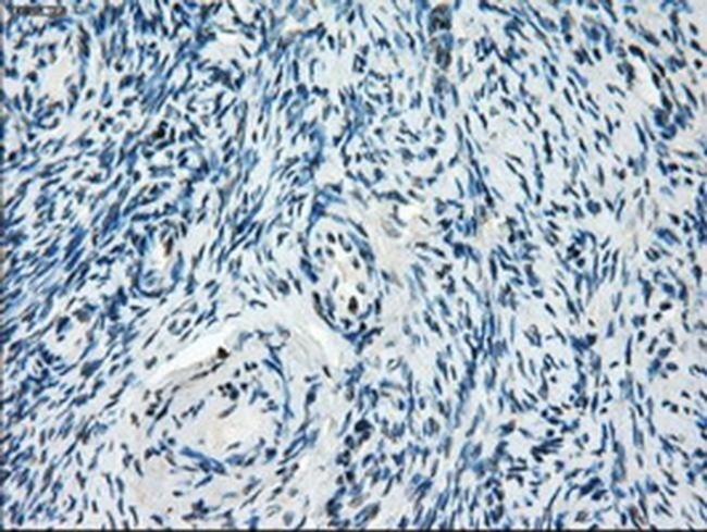 ZFP36 Antibody in Immunohistochemistry (Paraffin) (IHC (P))