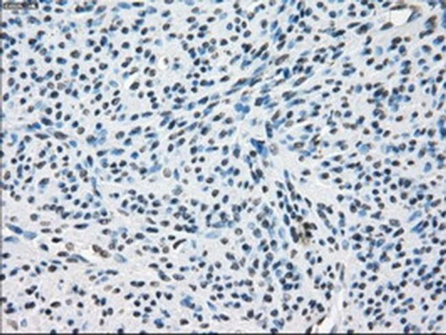 ZFP36 Antibody in Immunohistochemistry (Paraffin) (IHC (P))