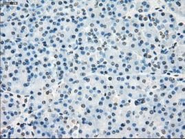 Cytochrome P450 Reductase Antibody in Immunohistochemistry (Paraffin) (IHC (P))