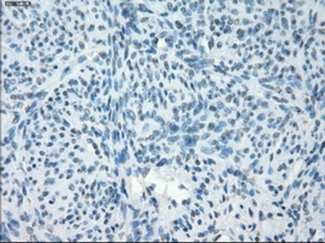 PDE10A Antibody in Immunohistochemistry (Paraffin) (IHC (P))