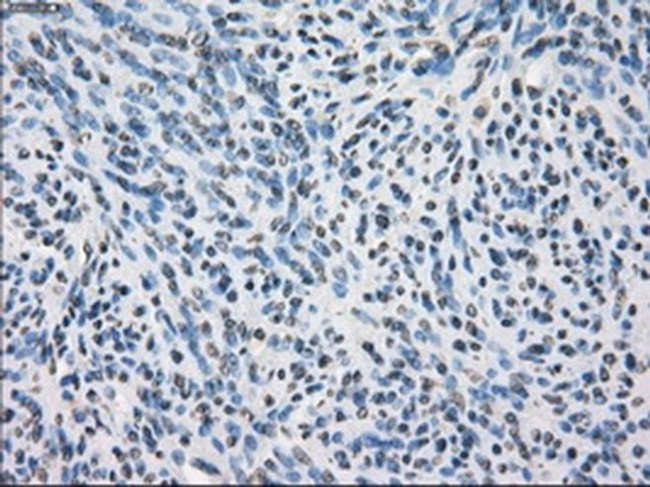 SLC2A6 Antibody in Immunohistochemistry (Paraffin) (IHC (P))