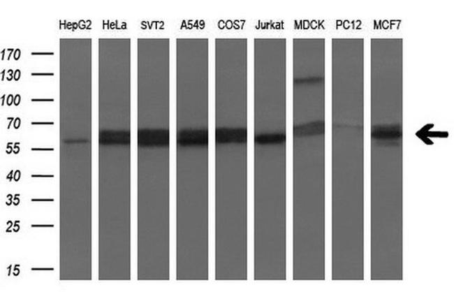 SLC2A6 Antibody in Western Blot (WB)