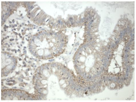 PRKAR1A Antibody in Immunohistochemistry (Paraffin) (IHC (P))