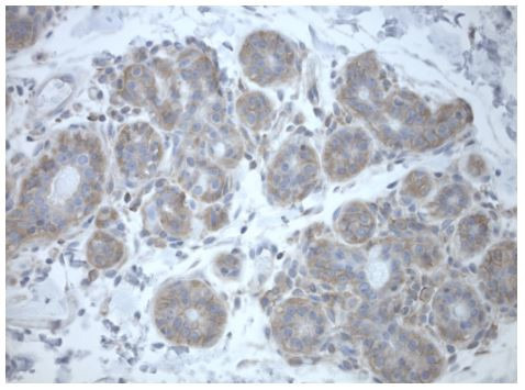 PRKAR1A Antibody in Immunohistochemistry (Paraffin) (IHC (P))