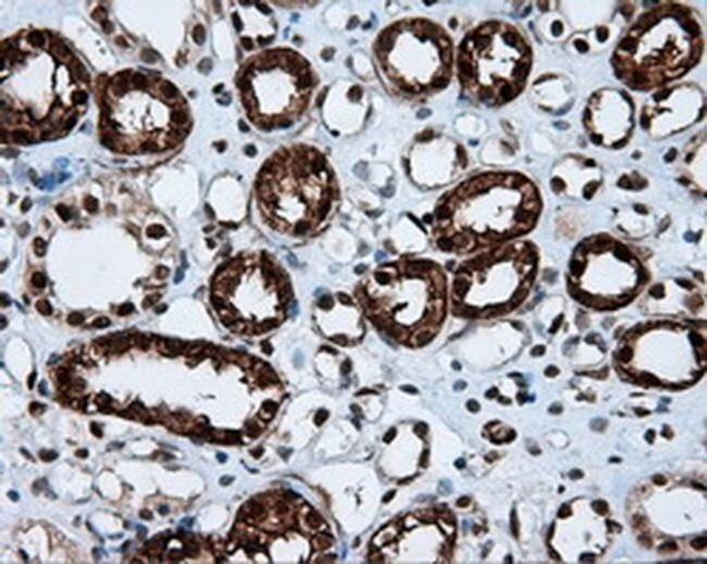 LTA4H Antibody in Immunohistochemistry (Paraffin) (IHC (P))