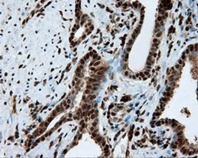 LTA4H Antibody in Immunohistochemistry (Paraffin) (IHC (P))