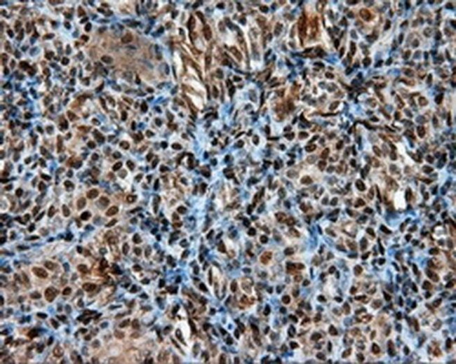 LTA4H Antibody in Immunohistochemistry (Paraffin) (IHC (P))