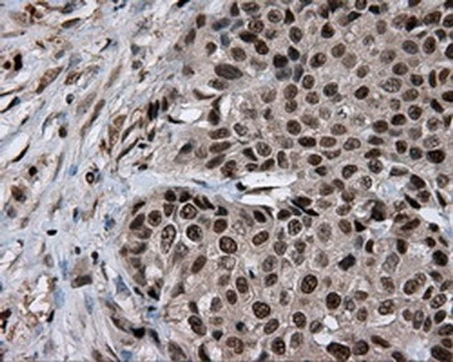 LTA4H Antibody in Immunohistochemistry (Paraffin) (IHC (P))