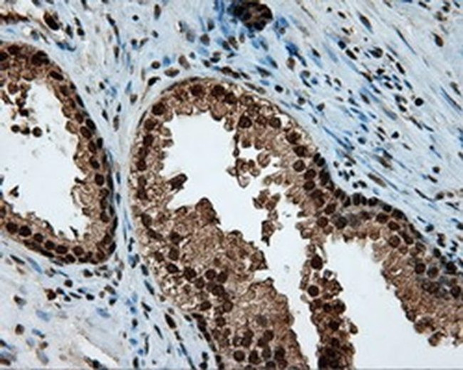 LTA4H Antibody in Immunohistochemistry (Paraffin) (IHC (P))