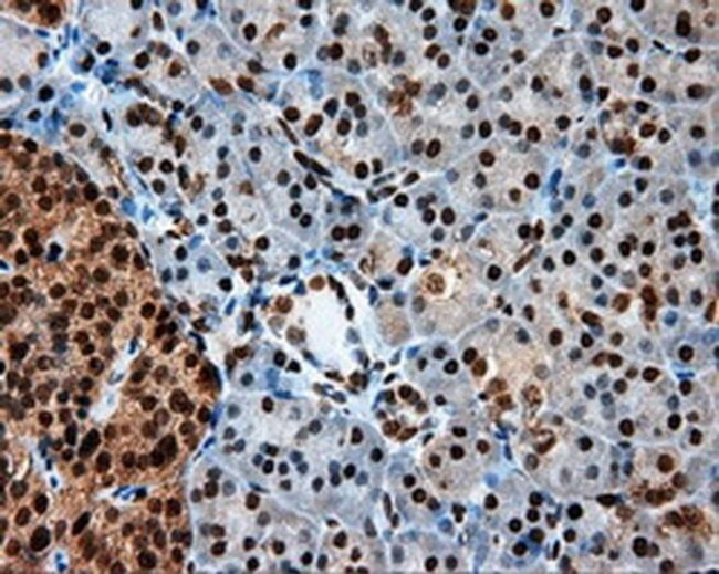 LTA4H Antibody in Immunohistochemistry (Paraffin) (IHC (P))