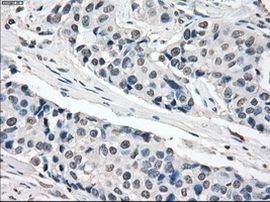 XRCC4 Antibody in Immunohistochemistry (Paraffin) (IHC (P))