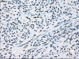 XRCC4 Antibody in Immunohistochemistry (Paraffin) (IHC (P))