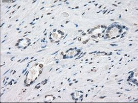 XRCC4 Antibody in Immunohistochemistry (Paraffin) (IHC (P))