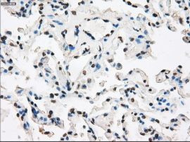 XRCC4 Antibody in Immunohistochemistry (Paraffin) (IHC (P))