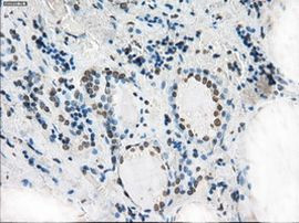 XRCC4 Antibody in Immunohistochemistry (Paraffin) (IHC (P))