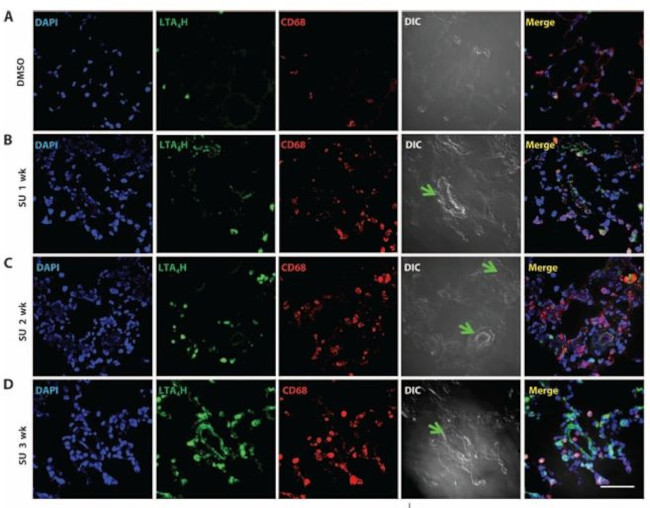 LTA4H Antibody in Immunohistochemistry (IHC)