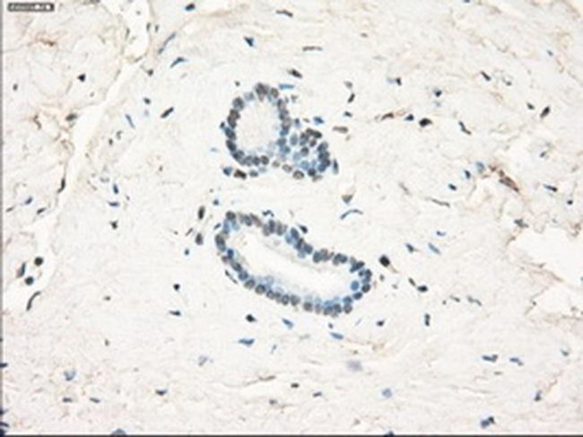 LTA4H Antibody in Immunohistochemistry (Paraffin) (IHC (P))