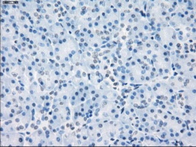 LTA4H Antibody in Immunohistochemistry (Paraffin) (IHC (P))