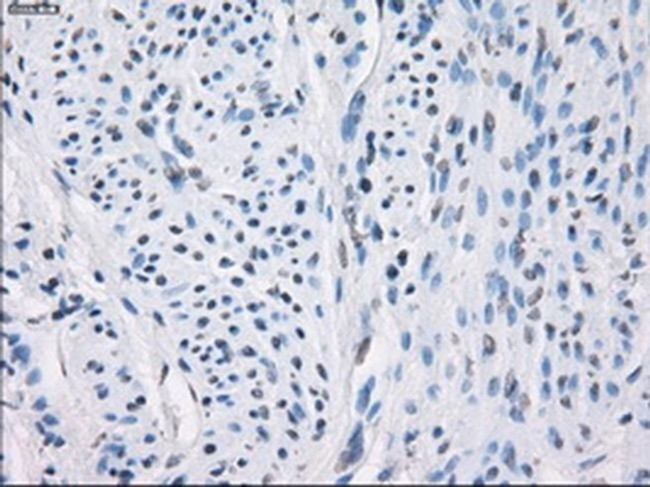 LTA4H Antibody in Immunohistochemistry (Paraffin) (IHC (P))