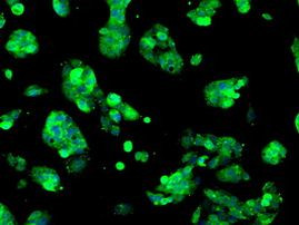 Sorbitol Dehydrogenase Antibody in Immunocytochemistry (ICC/IF)