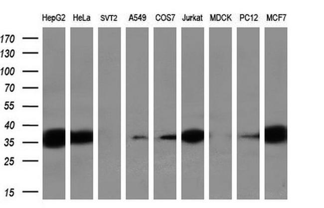 Sorbitol Dehydrogenase Antibody in Western Blot (WB)