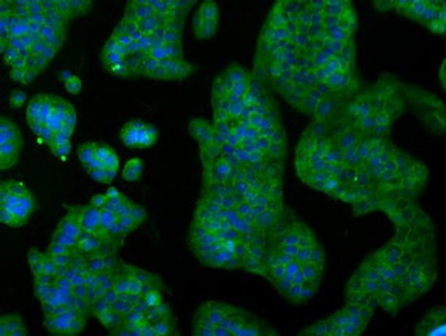 RNF144B Antibody in Immunocytochemistry (ICC/IF)