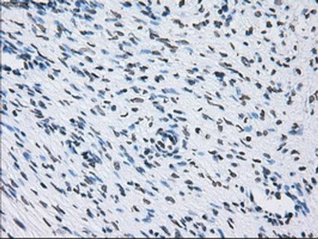 ID3 Antibody in Immunohistochemistry (Paraffin) (IHC (P))