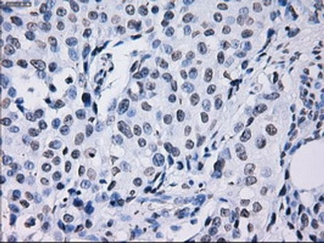 ID3 Antibody in Immunohistochemistry (Paraffin) (IHC (P))