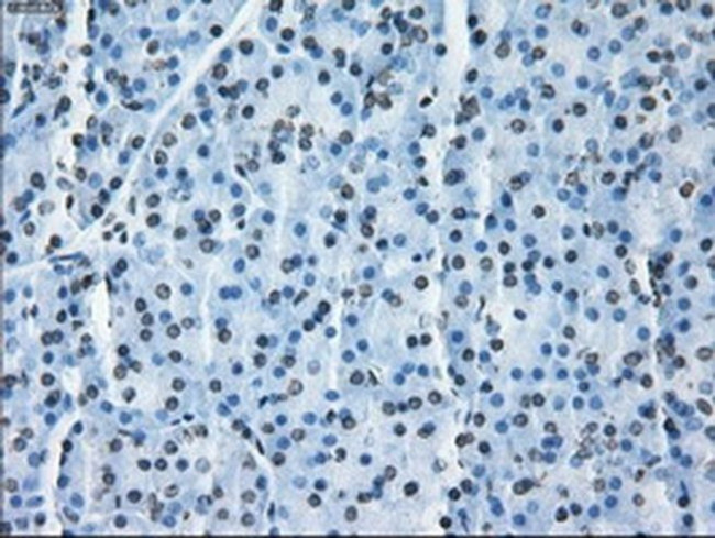 ID3 Antibody in Immunohistochemistry (Paraffin) (IHC (P))