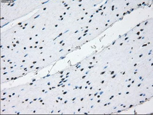 ID3 Antibody in Immunohistochemistry (Paraffin) (IHC (P))