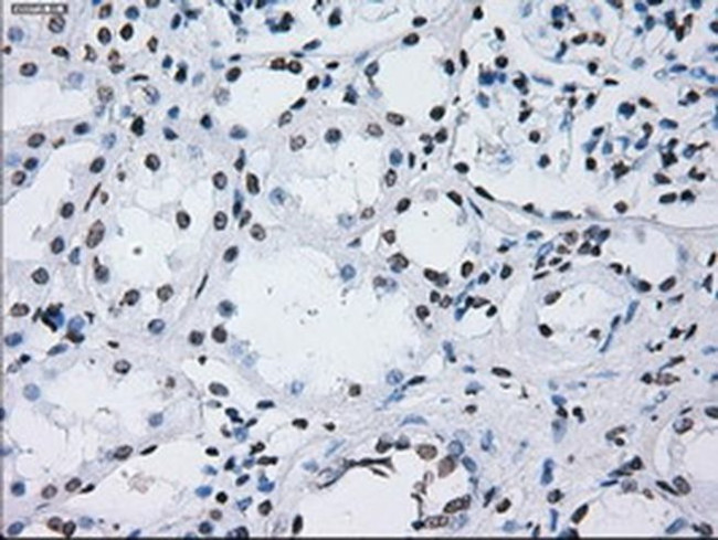 ID3 Antibody in Immunohistochemistry (Paraffin) (IHC (P))