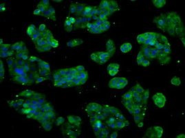 CYP2E1 Antibody in Immunocytochemistry (ICC/IF)