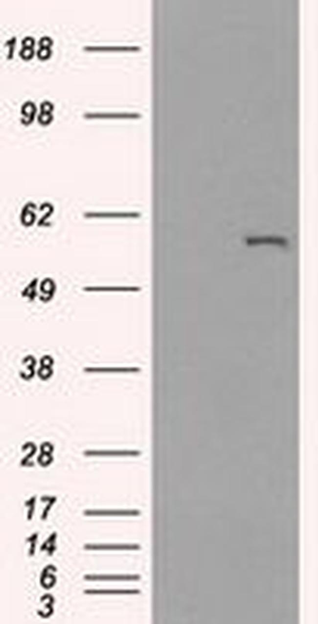 CYP2E1 Antibody in Western Blot (WB)