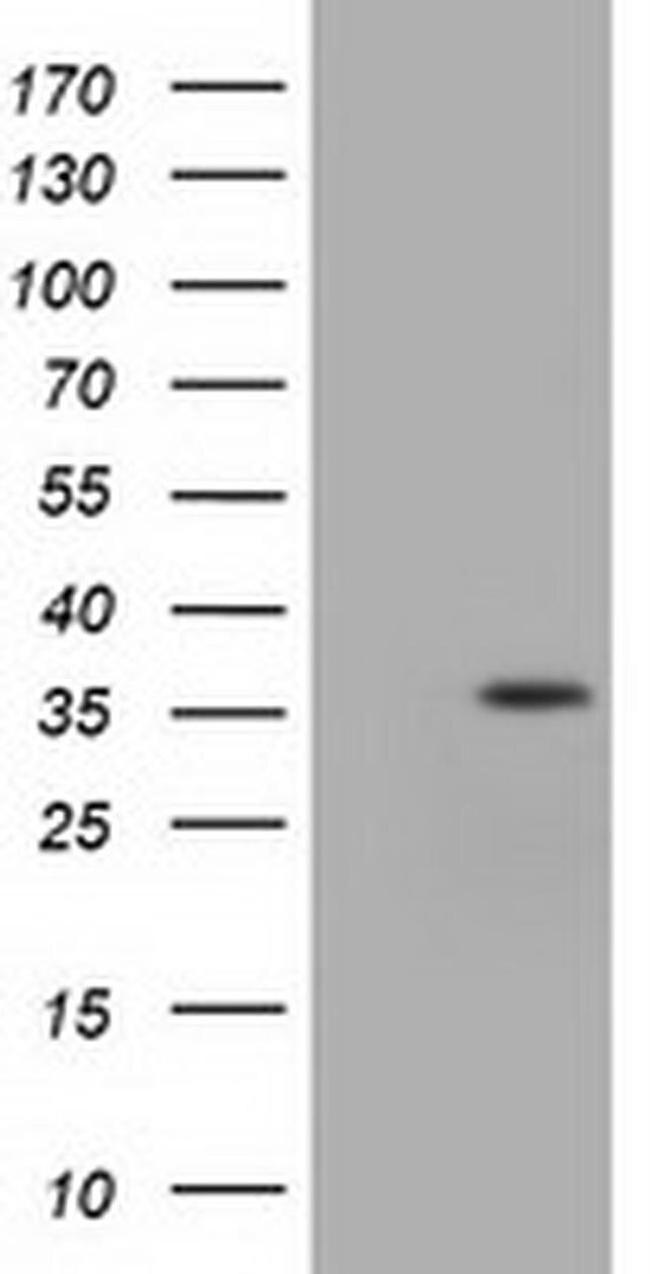 IDH3A Antibody in Western Blot (WB)