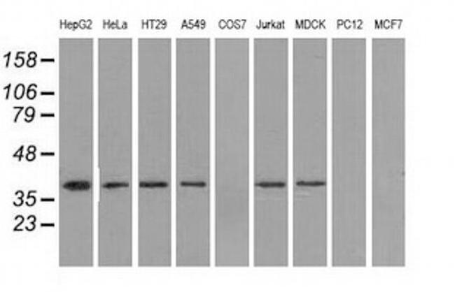 IDH3A Antibody in Western Blot (WB)