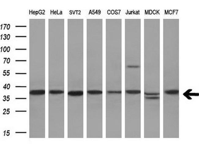 AKR1A1 Antibody in Western Blot (WB)