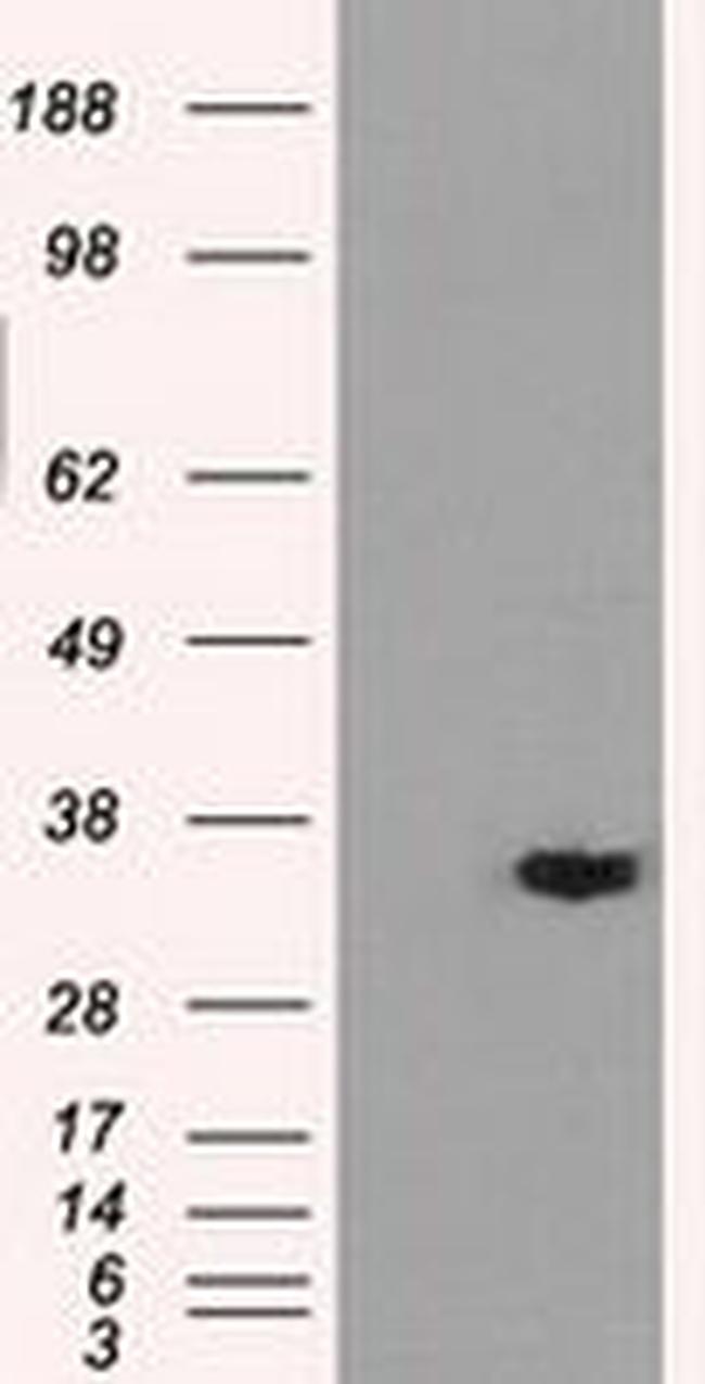 AKR1A1 Antibody in Western Blot (WB)