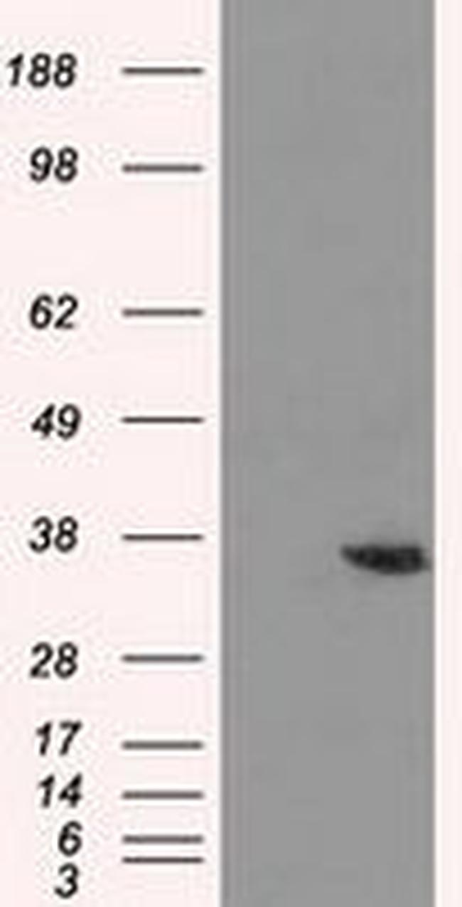 AKR1A1 Antibody in Western Blot (WB)